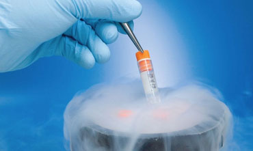 Frozen Embryo Transfer